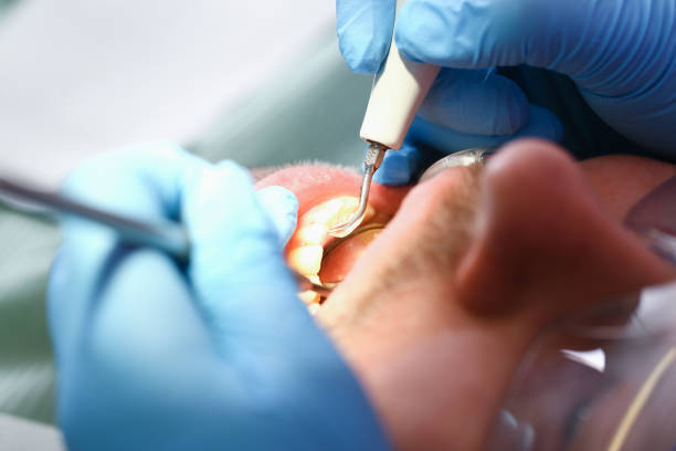 Best Emergency Tooth Extraction in Skyline Ganipa, NM