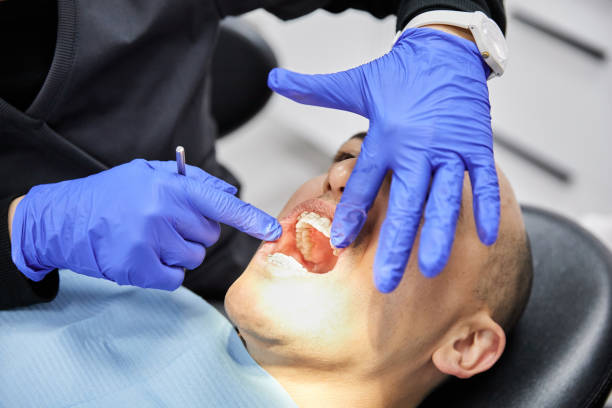 Best Emergency Treatment for Dental Infections or Abscesses in Skyline Ganipa, NM