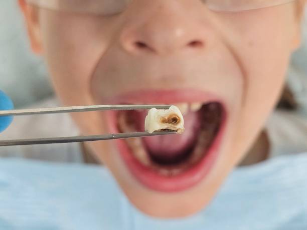 Best Same-Day Emergency Dental Services in Skyline Ganipa, NM